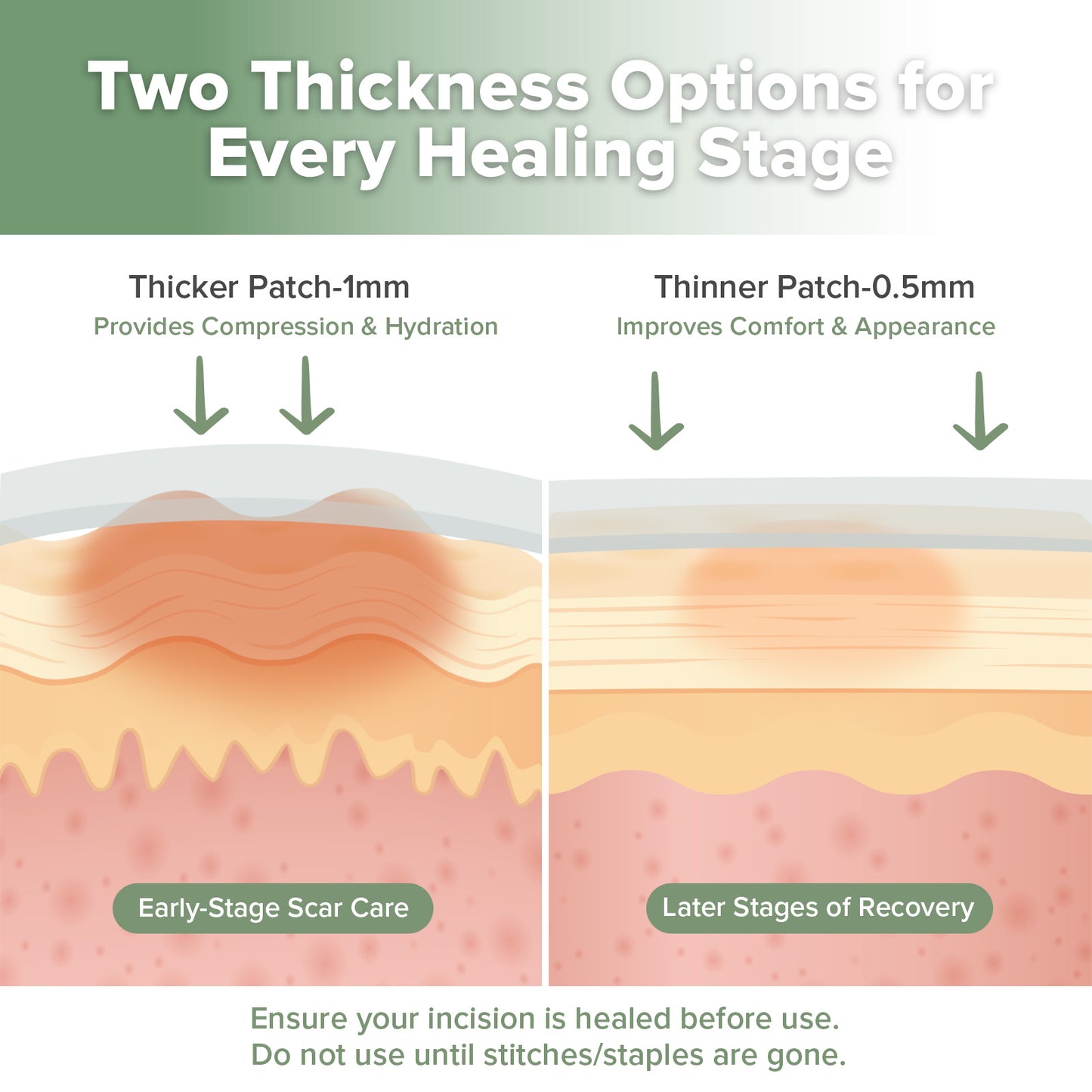 Haakaa Mum C-Section Scar Silicone Patches - 6pc (3 x 0.5mm + 3 x 1mm)